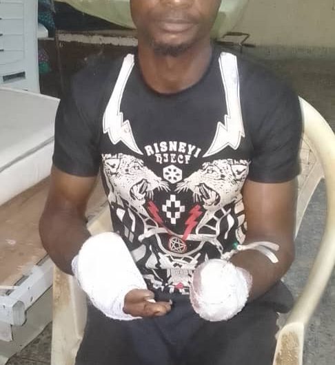 Man Chops Off Brother’s Hand In Cross River Over Cocoa Farm Dispute