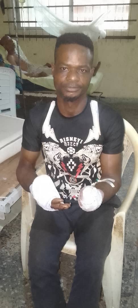 Man Chops Off Brother’s Hand In Cross River Over Cocoa Farm Dispute